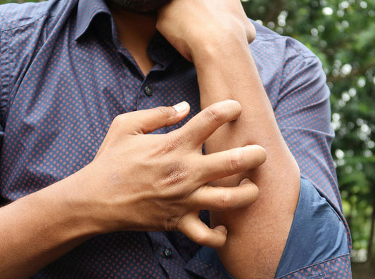 Best Laundry Detergent for Sensitive Skin: What to Look For